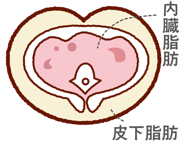 内臓脂肪型肥満〔りんご型〕