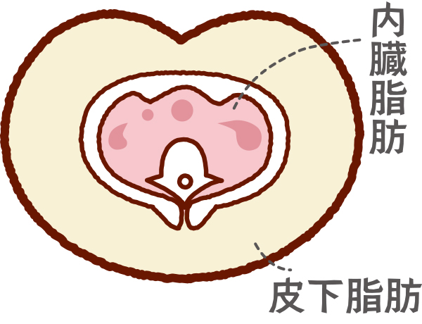 皮下脂肪型肥満〔洋なし型〕